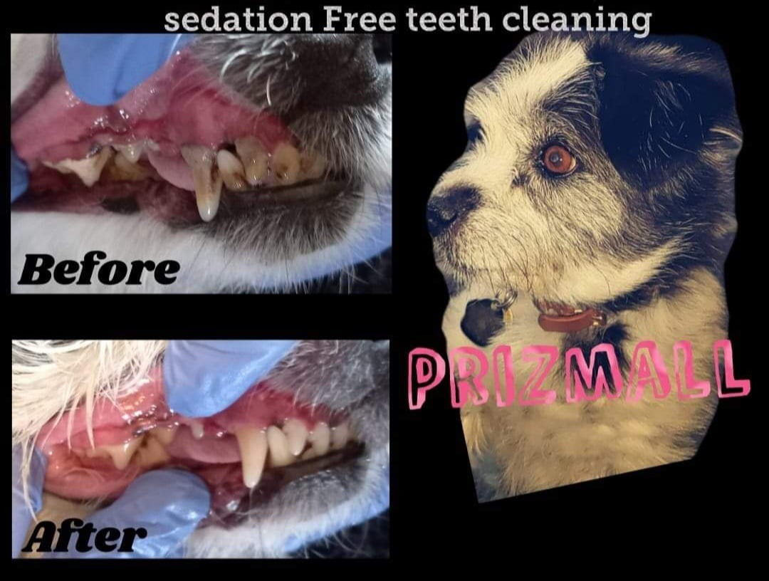 Sedation Free Teeth Cleaning